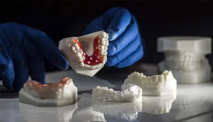 impression 3d dans le medical prothèse dentaire