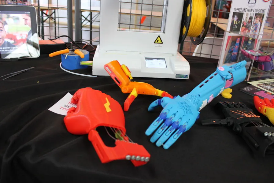 prothèses imprimé en 3d